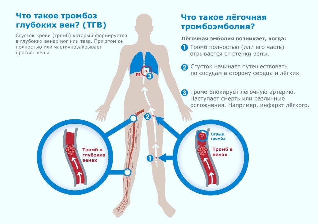 народные методы избавления от паразитов народные методы избавления от паразитов